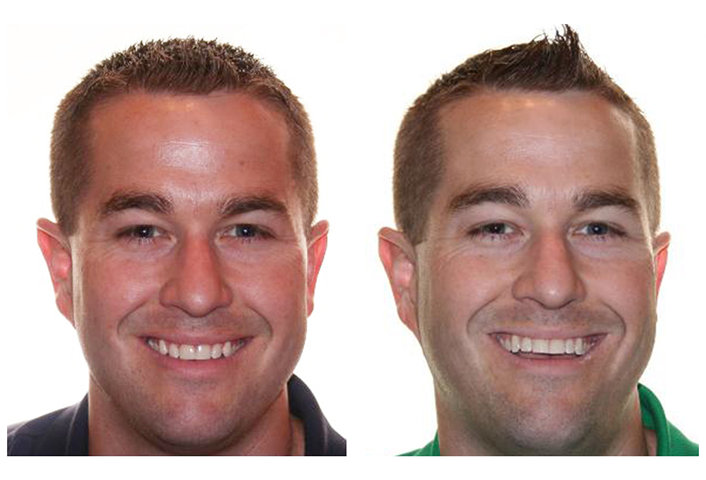 Elite Dental of Towson