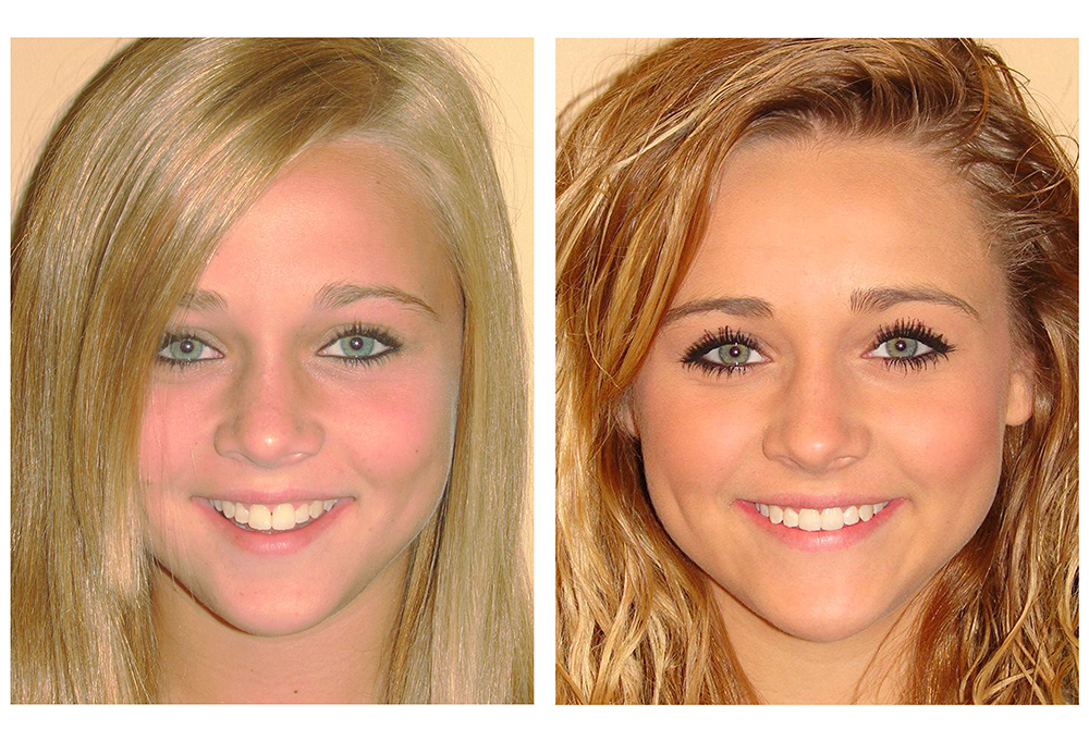 Elite Dental of Towson